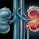 Pediatric Urinary Stone Disease