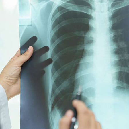 Reduced-Lung-Function-in-Oil-Spill-Responder