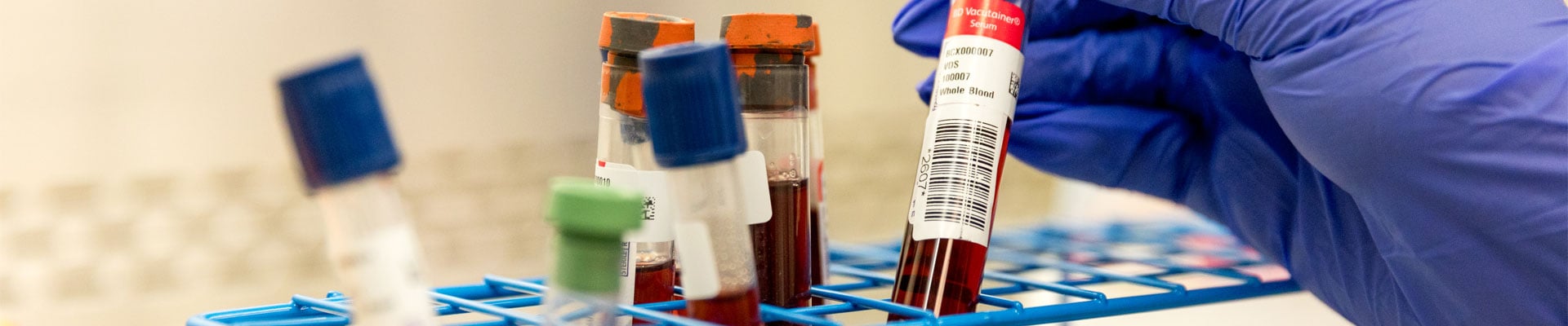 Laboratory Capabilities - DLH